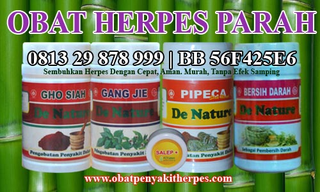 Illustration for article titled Obat Penyakit Herpes Tradisional
